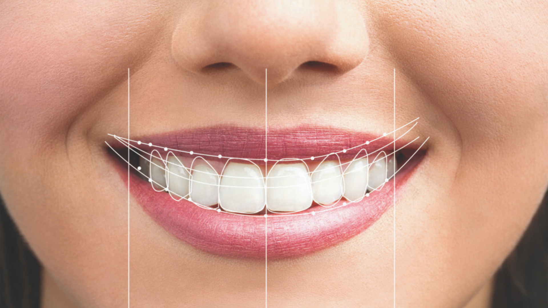 cuanto-ahorras-con-el-seguro-dental