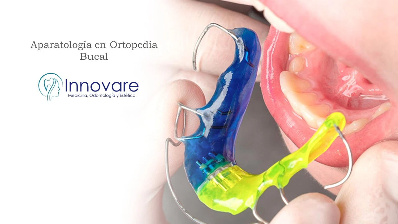 Aparatología en Ortopedia Bucal